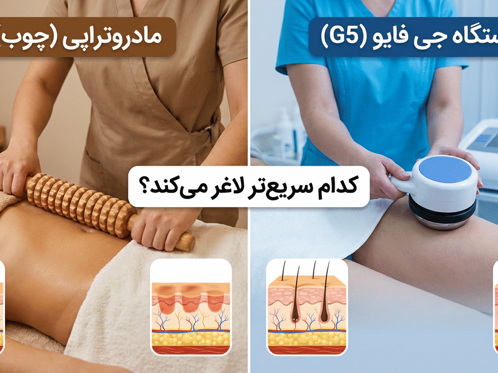 مادروتراپی (ماساژ با چوب) در برابر دستگاه جی فایو