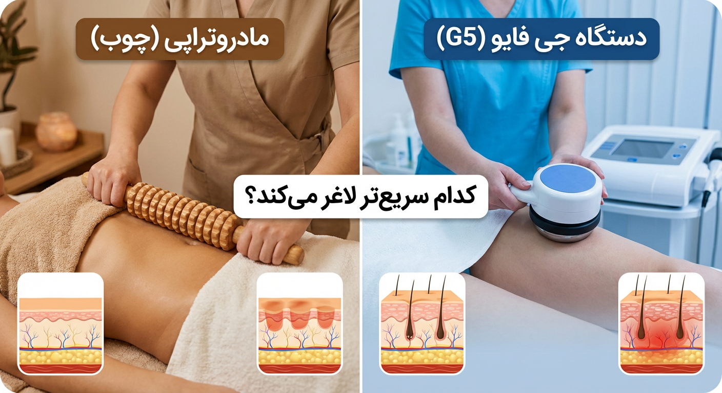 مادروتراپی (ماساژ با چوب) در برابر دستگاه جی فایو